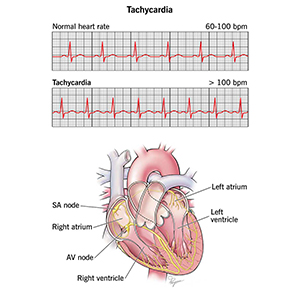 عوامل موثر بر ضربان قلب