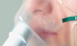 انواع ماسک اکسیژن تراپی