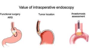 درمان بیماری ها با آندوسکوپی