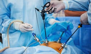 عوارض آندوسکوپی