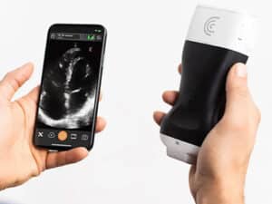 دستگاه سونوگرافی پرتابل جیبی